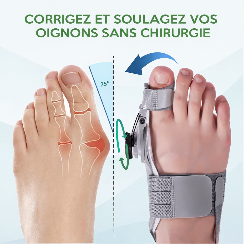 BuniControl™ – La Méthode Avancée pour Soulager l’Hallux Valgus Sans Chirurgie