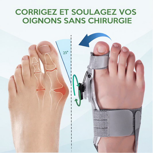 BuniControl™ – La Méthode Avancée pour Soulager l’Hallux Valgus Sans Chirurgie