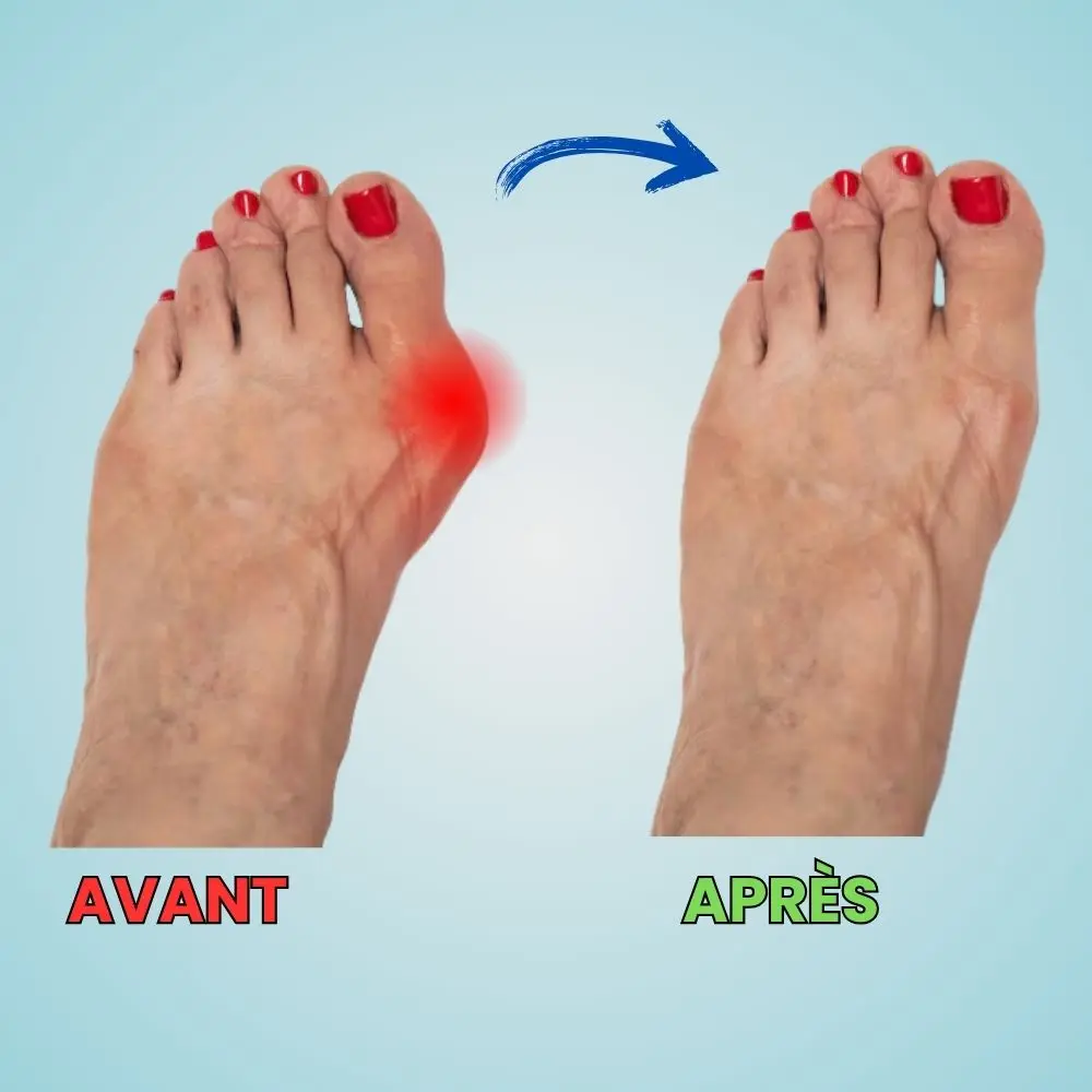 Solévia™ – Semelles Orthopédiques Anti-Douleur