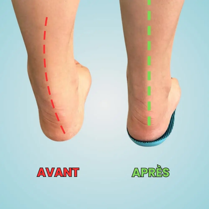 Solévia™ – Semelles Orthopédiques Anti-Douleur