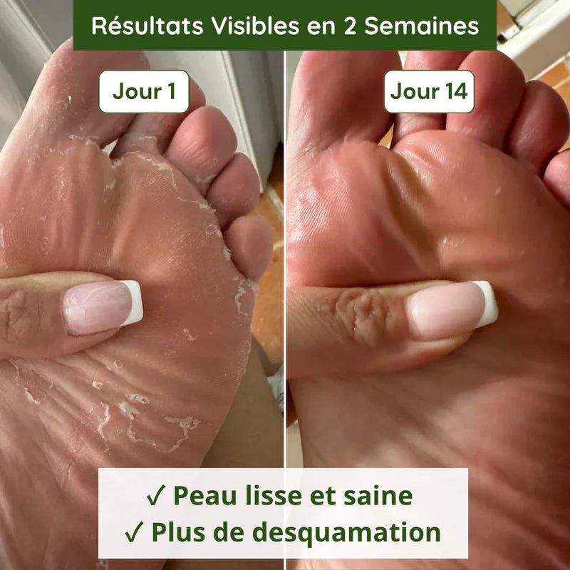 Savon Anti-Mycoses VELMORA