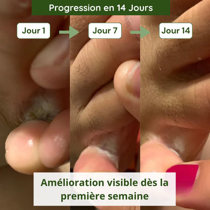 Savon Anti-Mycoses VELMORA